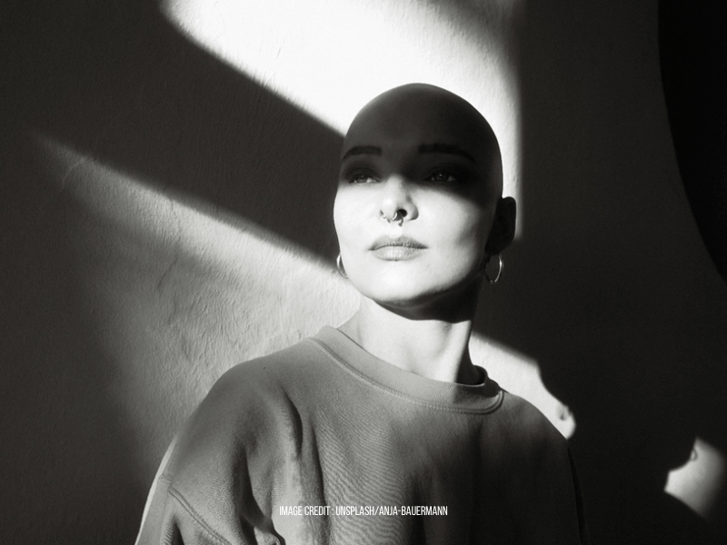 What&rsquo;s the real difference between alopecia and hair loss?